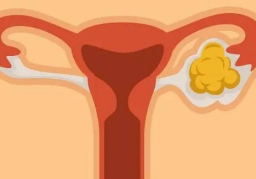 黃芪對(duì)子宮肌瘤的調(diào)理作用,黃芪可治療子宮肌瘤嗎